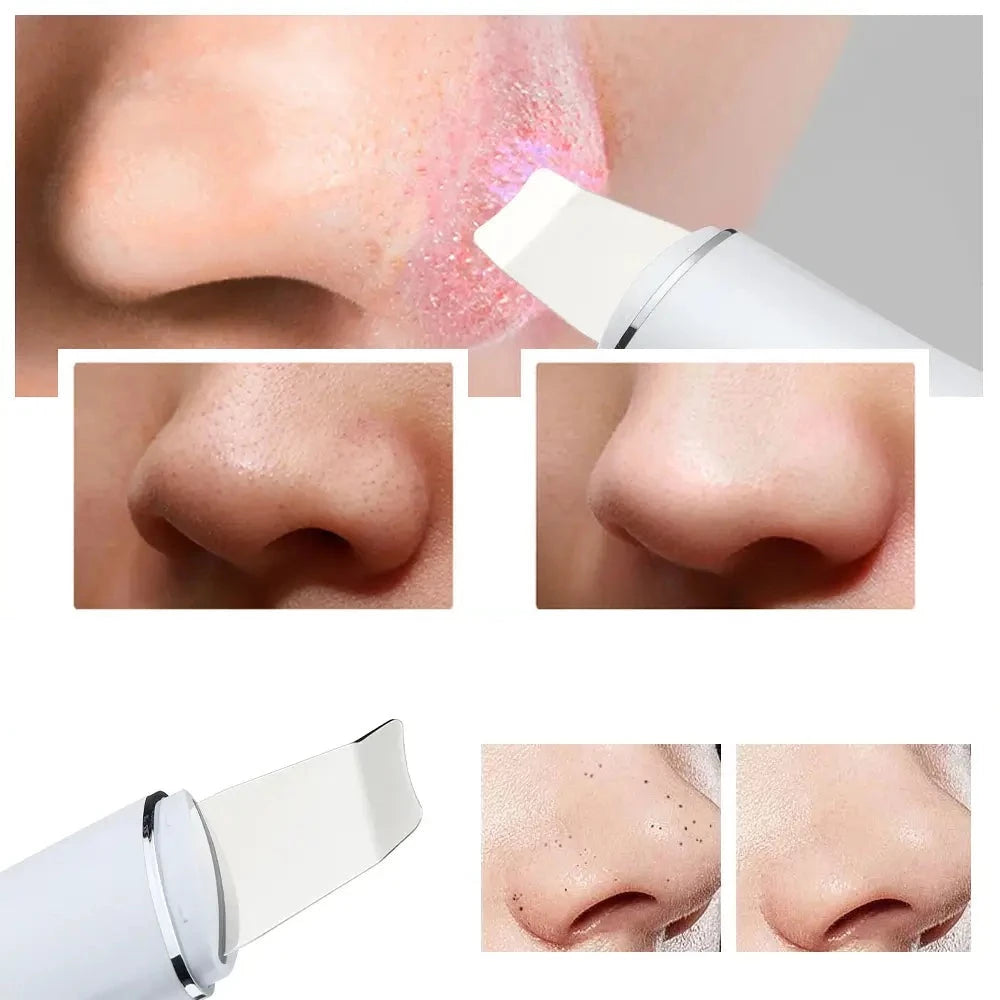 4-i-1 Ultrasonic Deep Facial Cleanser