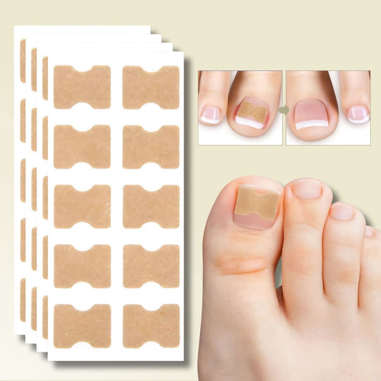 Nagelreparationsplåster för inåtväxta naglar 10-pack 0